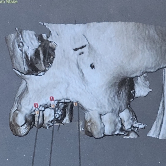 ⚠️Med.Photos ⚠️Warning - Picture 4 of 9